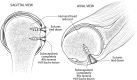 Fig 10