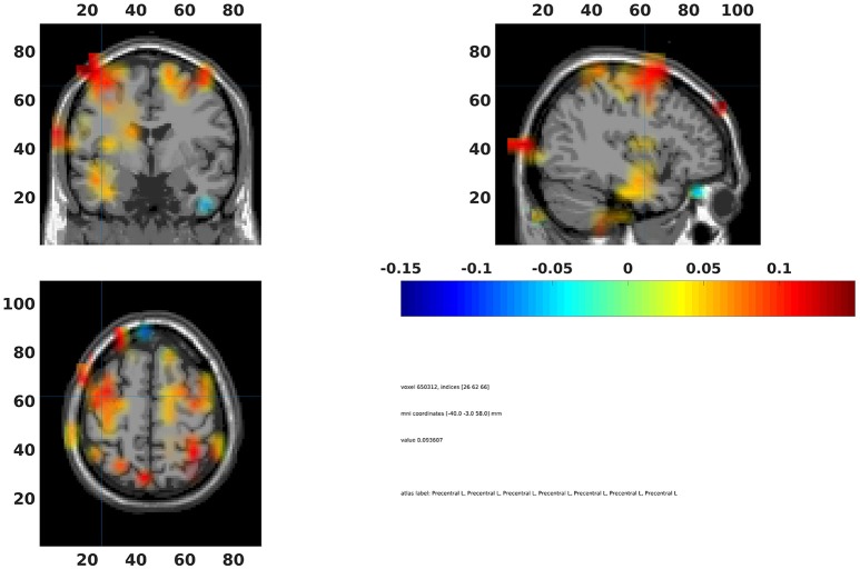 Figure 15