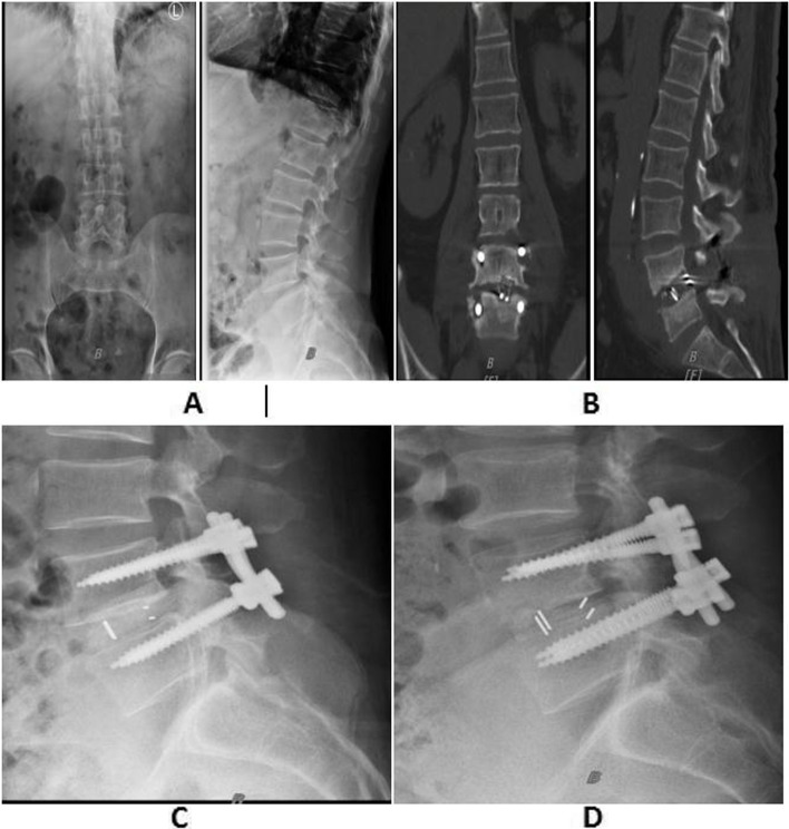 Fig. 2