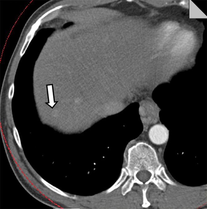 Figure 6b: