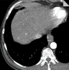 Figure 7b: