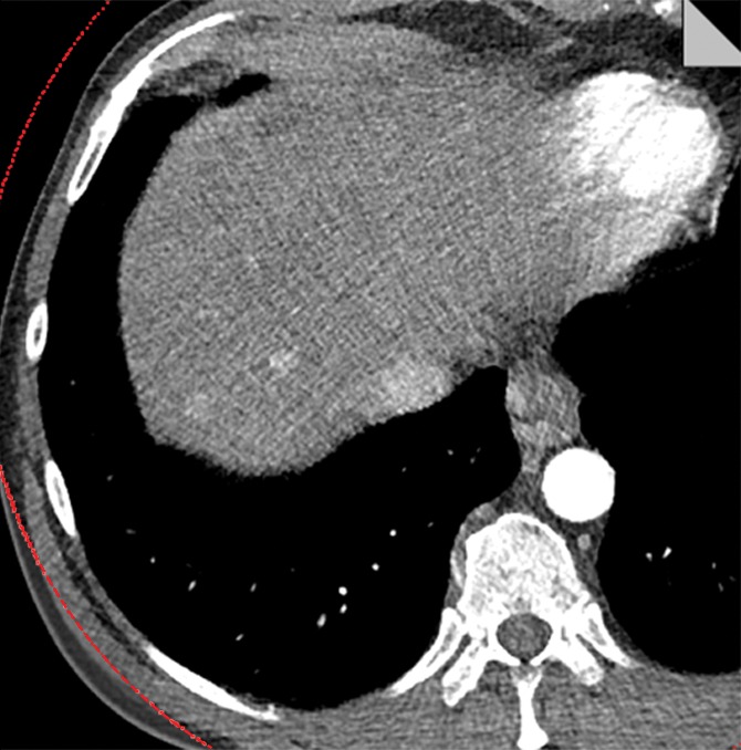 Figure 7a: