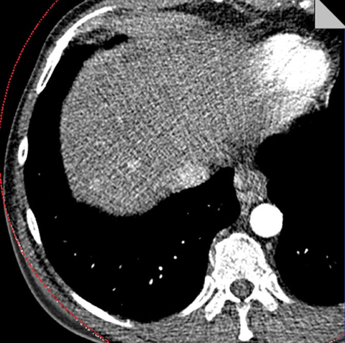 Figure 6c: