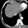 Figure 6d:
