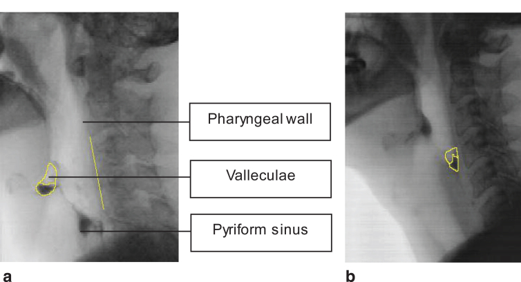 Fig.1