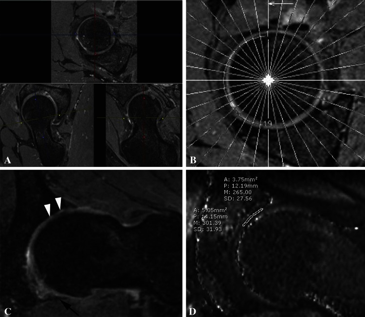 Fig. 2A–D