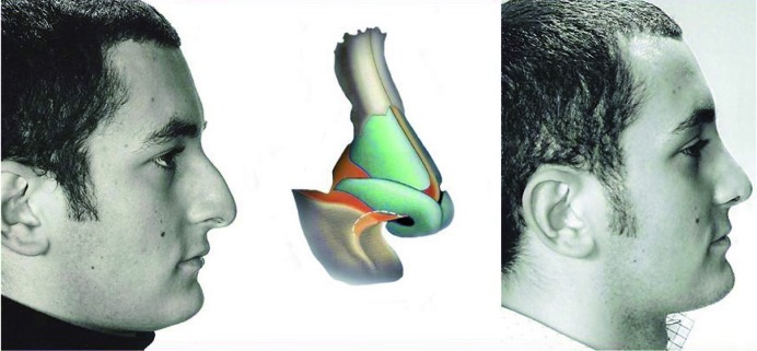 Fig. 12.