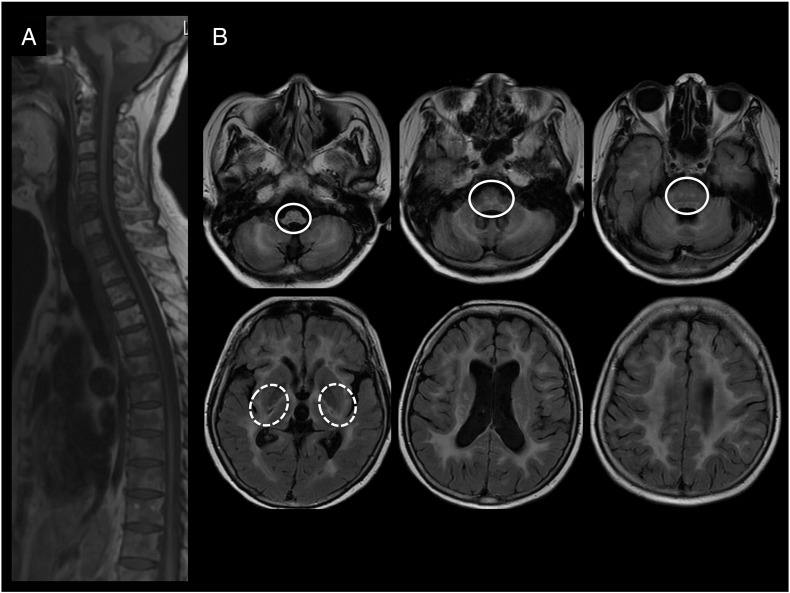 Fig. 1