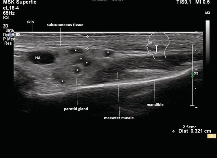 FIGURE 3