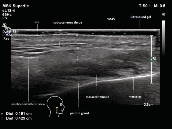 FIGURE 4