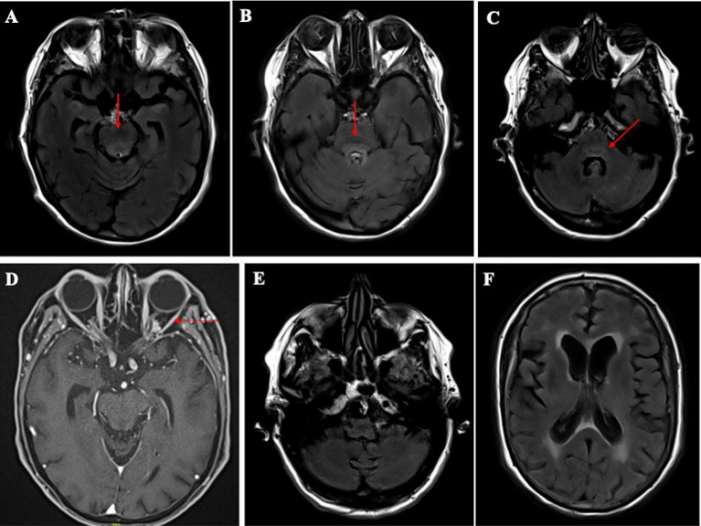 Figure 2