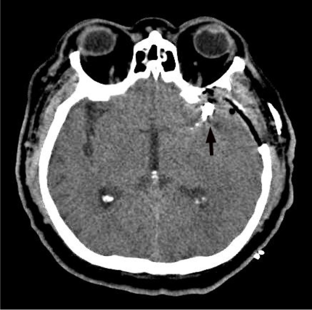 Fig. 5