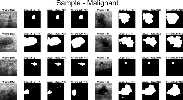 Fig 14