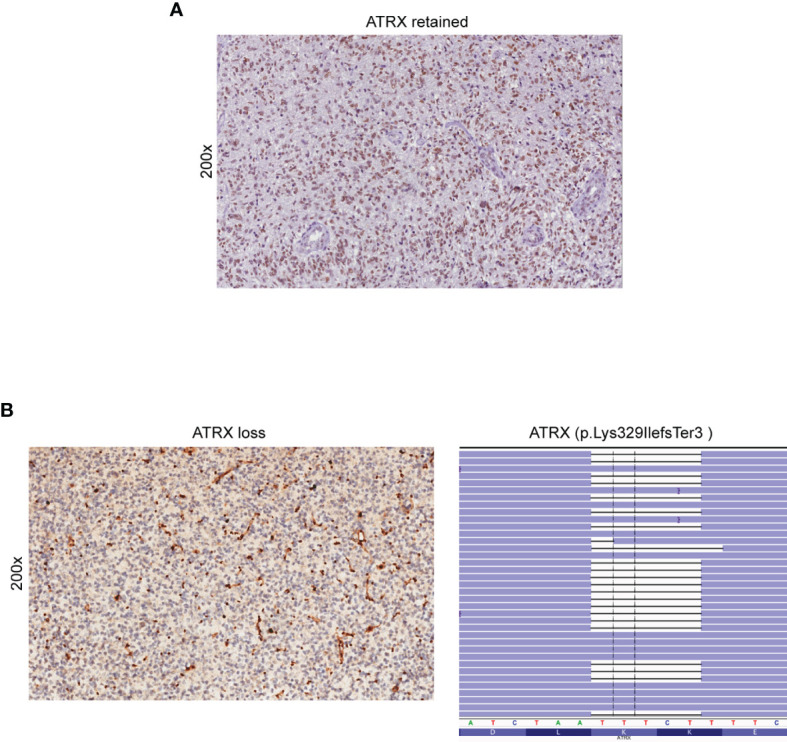 Figure 3