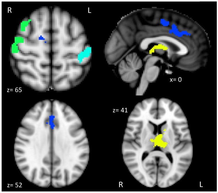 FIGURE 2