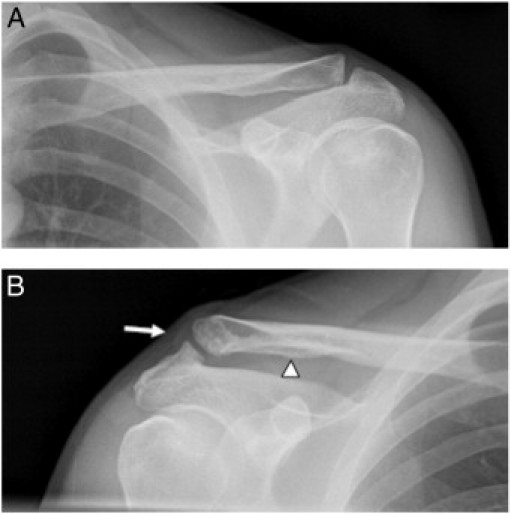 Fig 5