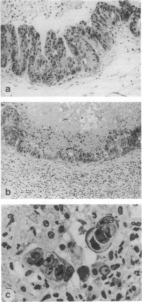 graphic file with name pnas01084-0288-a.jpg