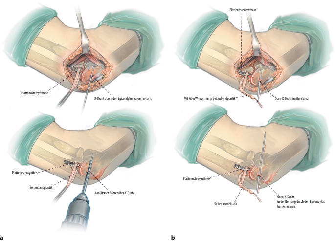 graphic file with name 64_2022_783_Fig8_HTML.jpg