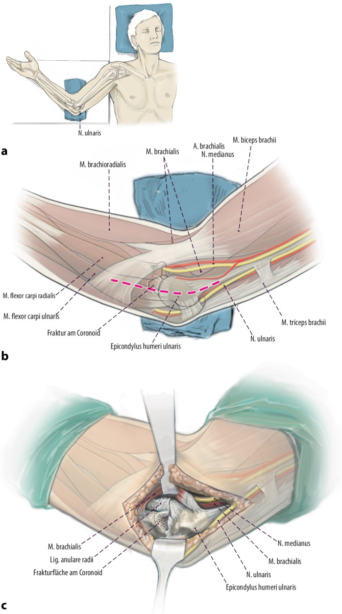 graphic file with name 64_2022_783_Fig4_HTML.jpg