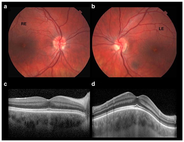 Fig. 2