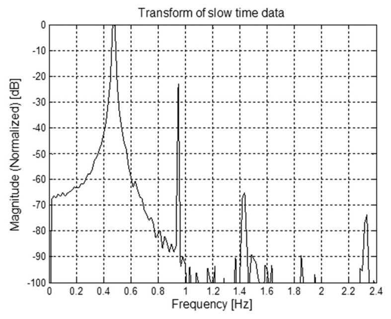 Figure 15.