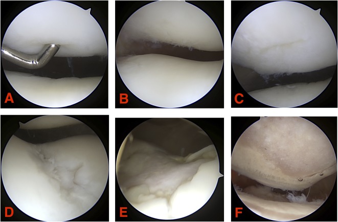 Fig. 1 A-F