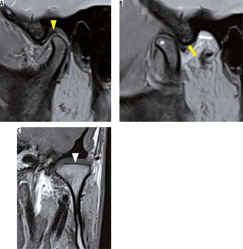 Figure 18