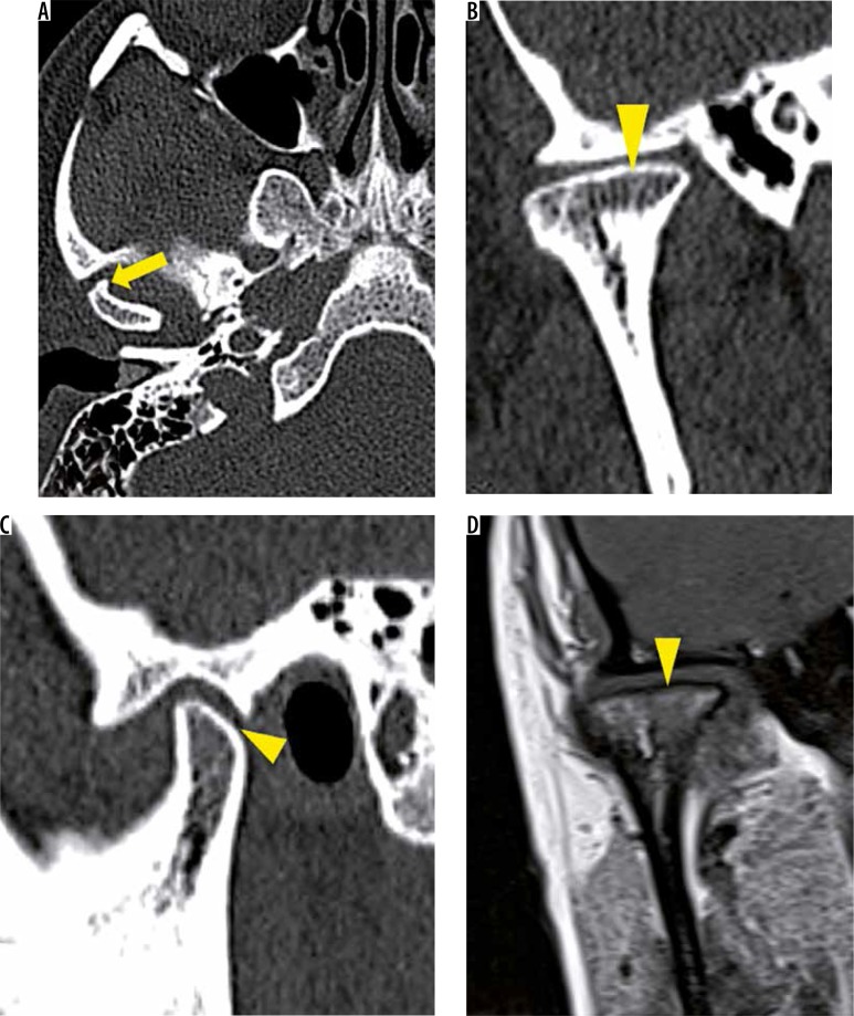 Figure 17