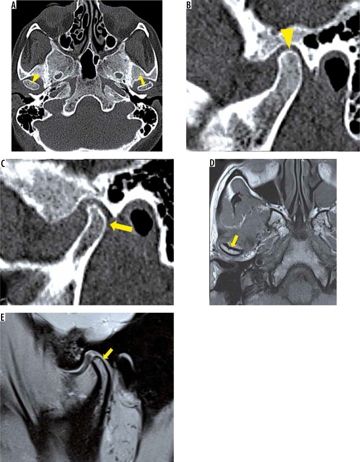 Figure 15