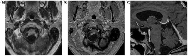 Figure 10