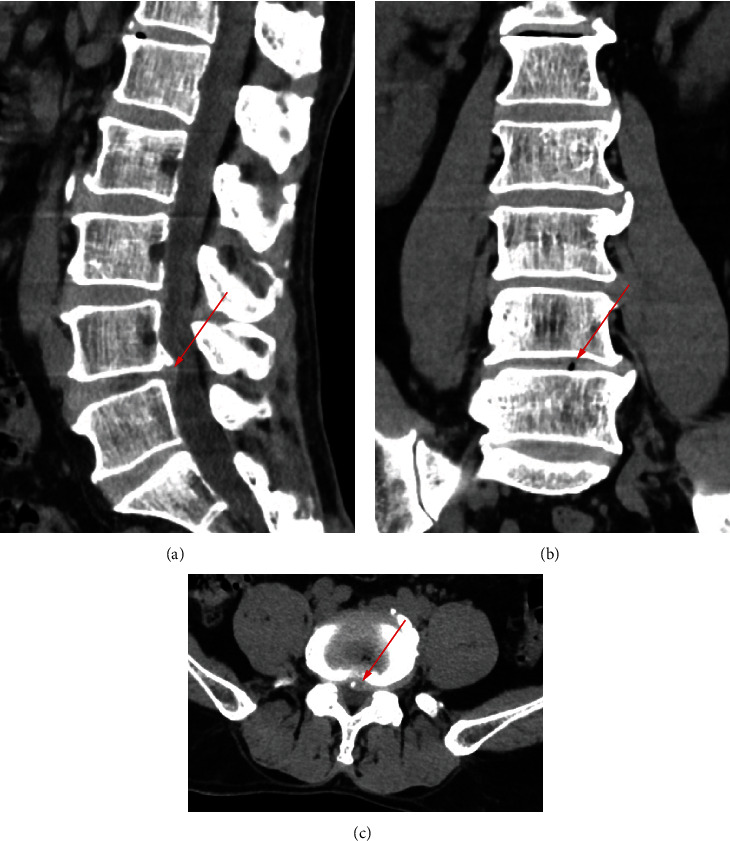 Figure 5