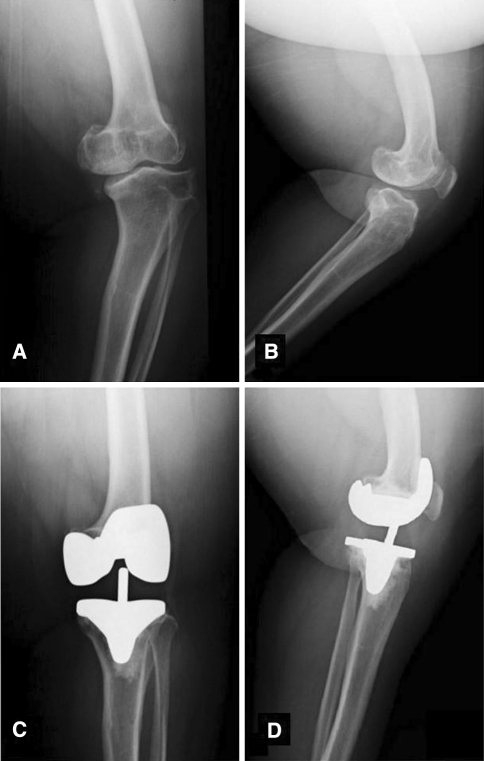 Fig. 2A–D