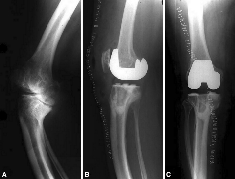 Fig. 3A–C