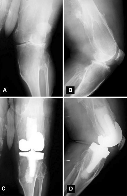 Fig. 1A–D