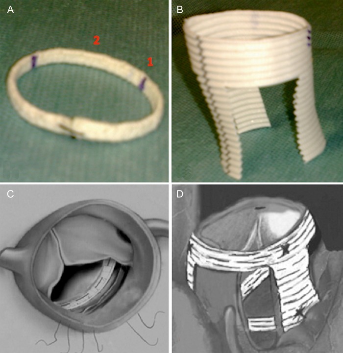 Figure 1: