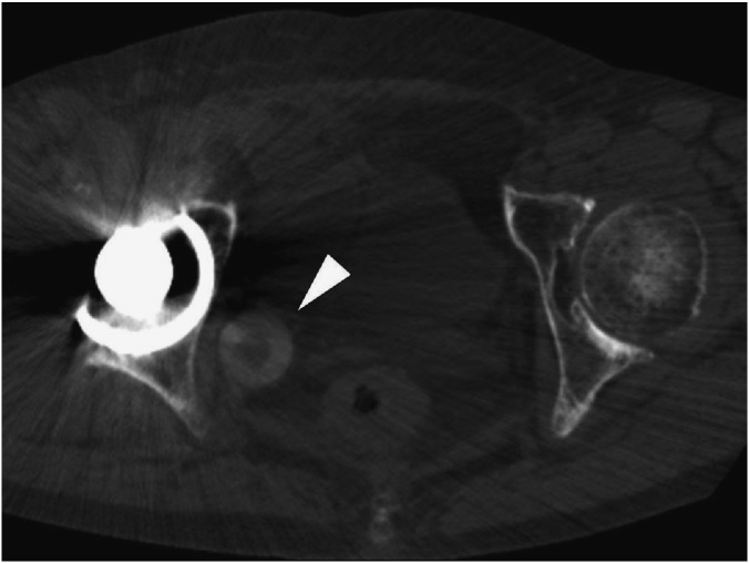 Fig. 3B