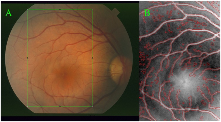 Fig 1