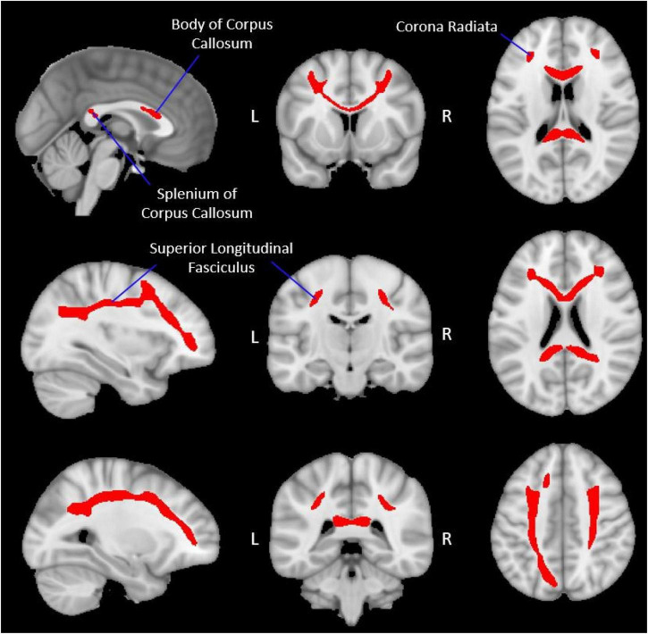 FIGURE 2