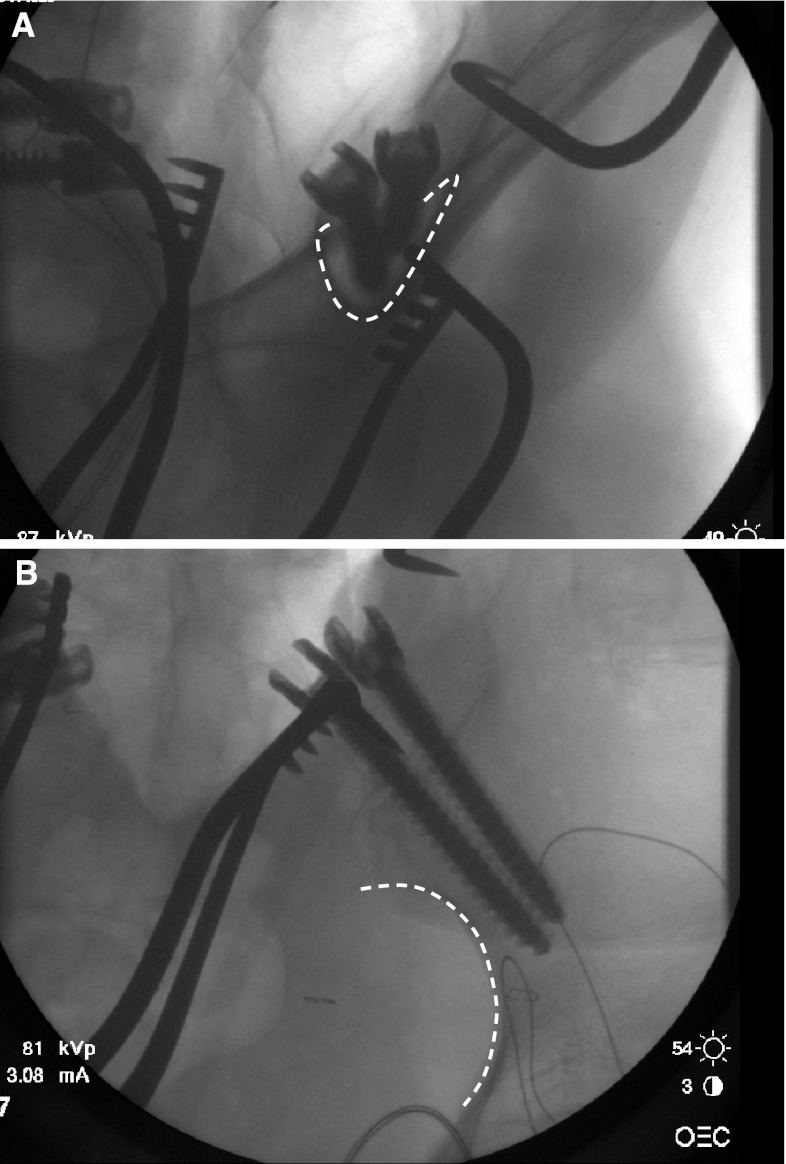 Fig. 1