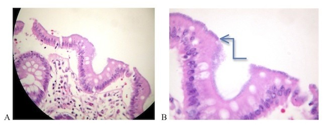 Fig 2.