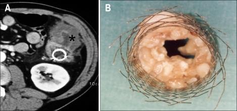 Fig. 11