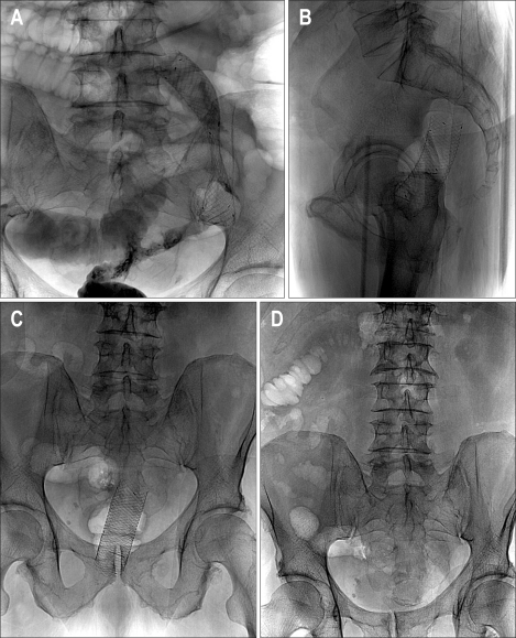 Fig. 5