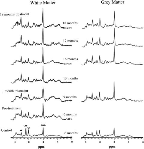 FIG. 11.