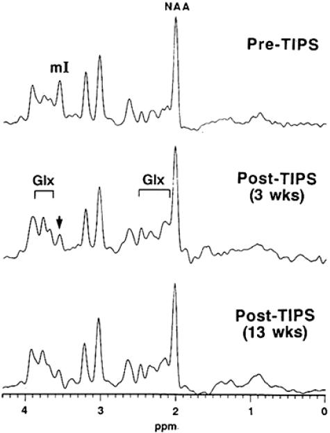 FIG. 12.