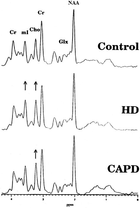 FIG. 14.