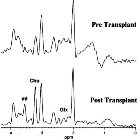 FIG. 13.