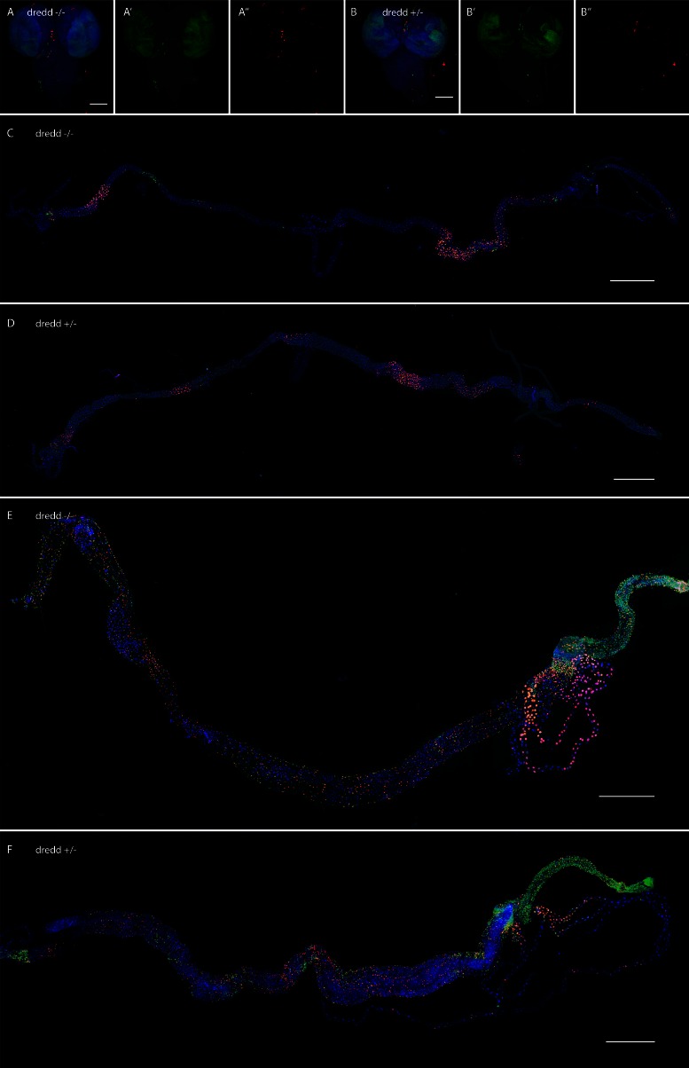 Figure 4—figure supplement 3.