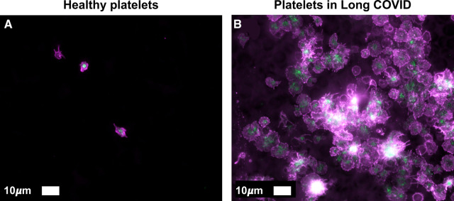 Figure 11.