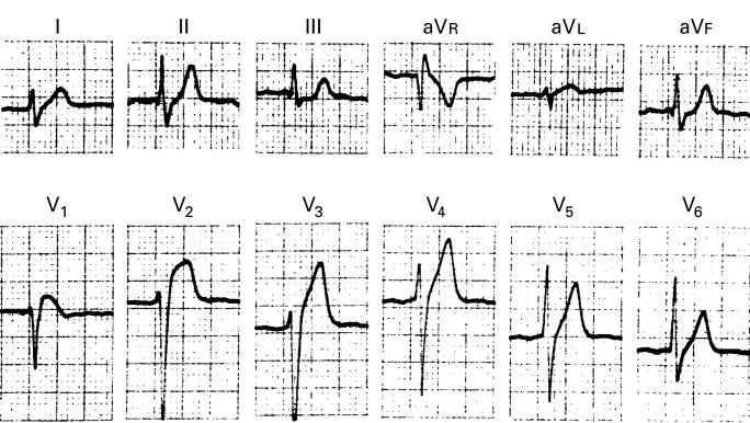 Figure 1  