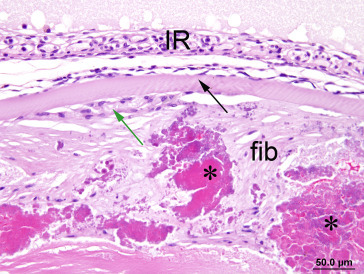 Figure 16.23